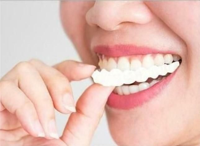 Snap-On Smile Veneers – Instant Perfect Smile Teeth Cover for Upper & Lower Jaw – One Size Fits All