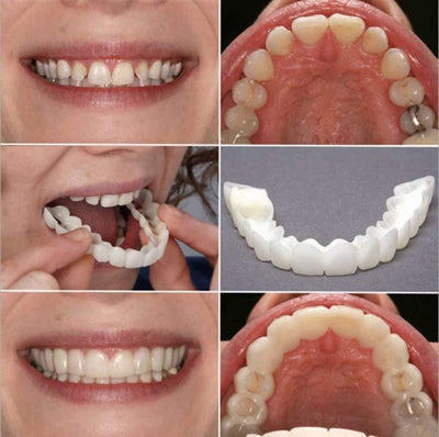 Instant Smile Veneers - Natural Looking Teeth Cover