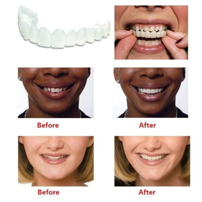 Instant Smile Veneers - Natural Looking Teeth Cover