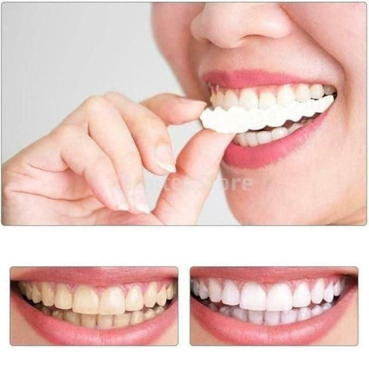 Snap-On Smile Veneers – Instant Perfect Smile Teeth Cover for Upper & Lower Jaw – One Size Fits All